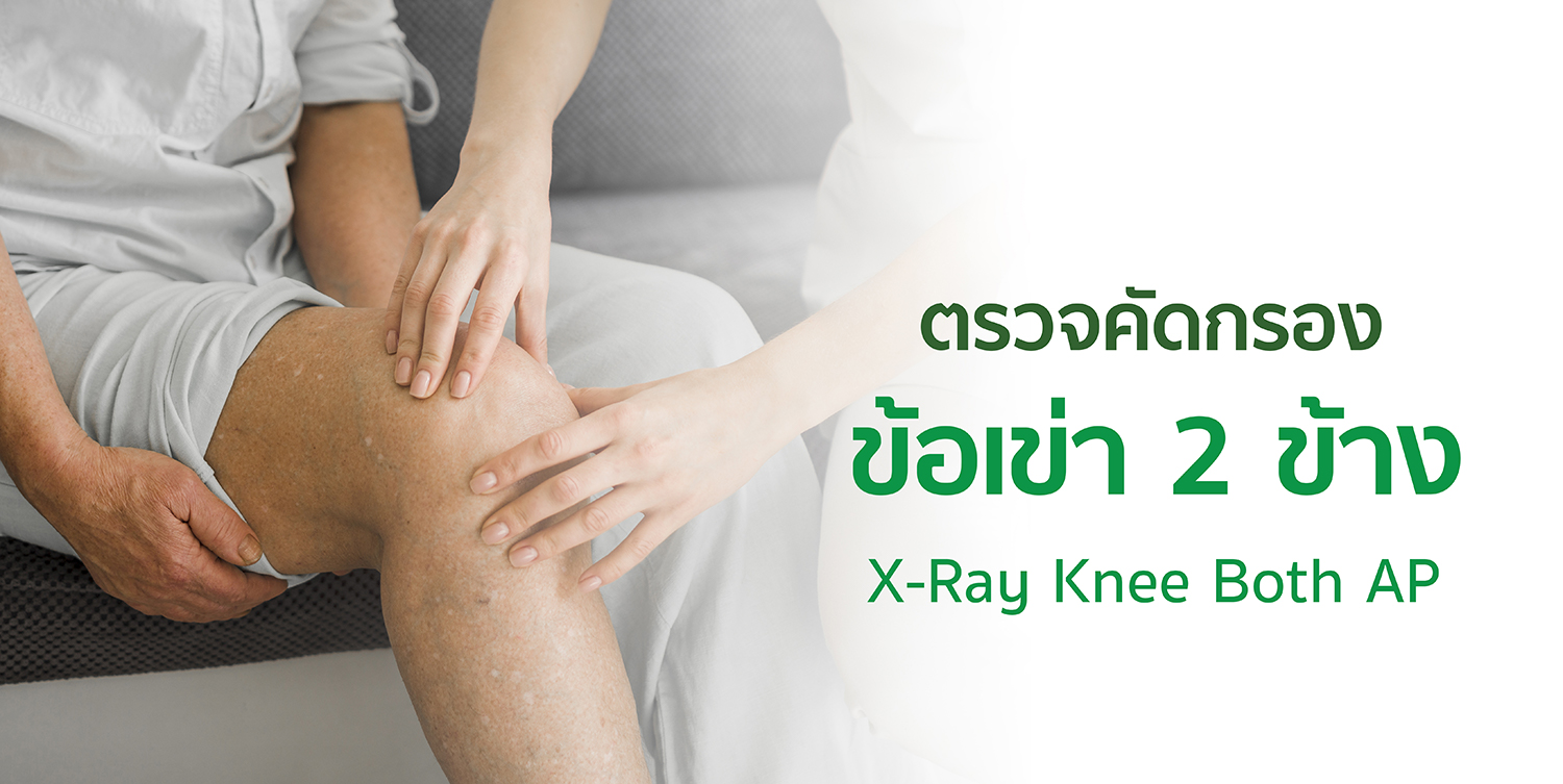 คัดกรองเข่า TH สไลด์